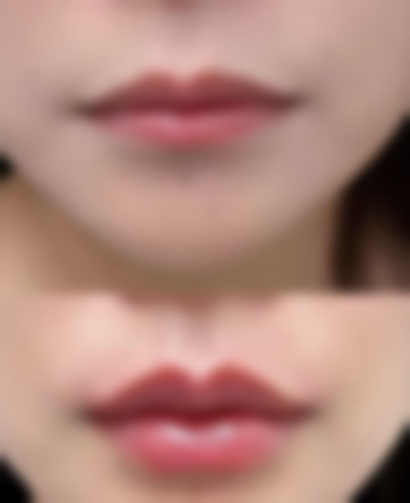 童迎迎医生项目收费价格