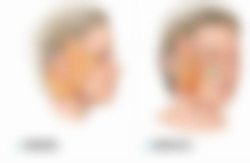 赵铁英医生技术优势