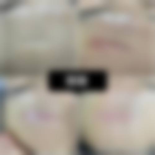 赵自然医生项目收费价格