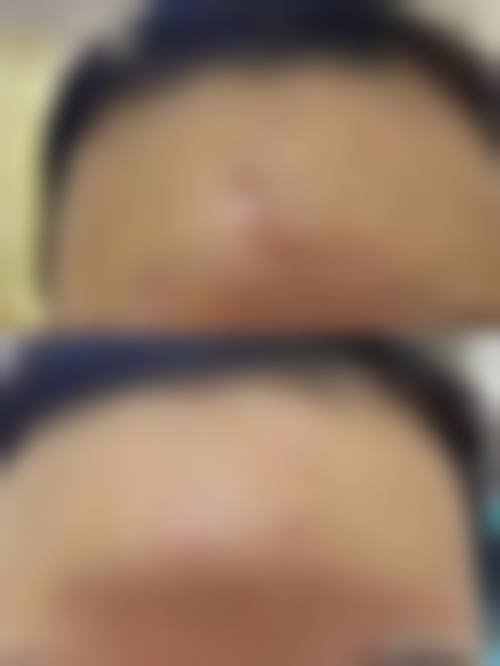 刘国锋医生预约挂号