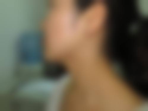 刘国锋医生口碑评价及反馈内容