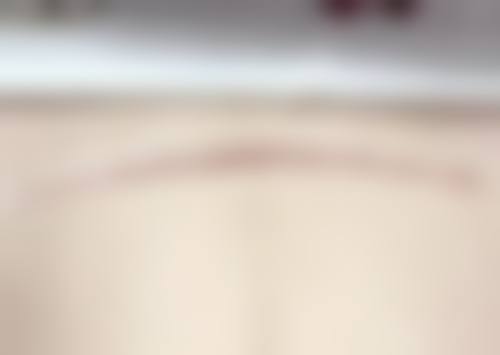 刘国锋医生项目收费价格