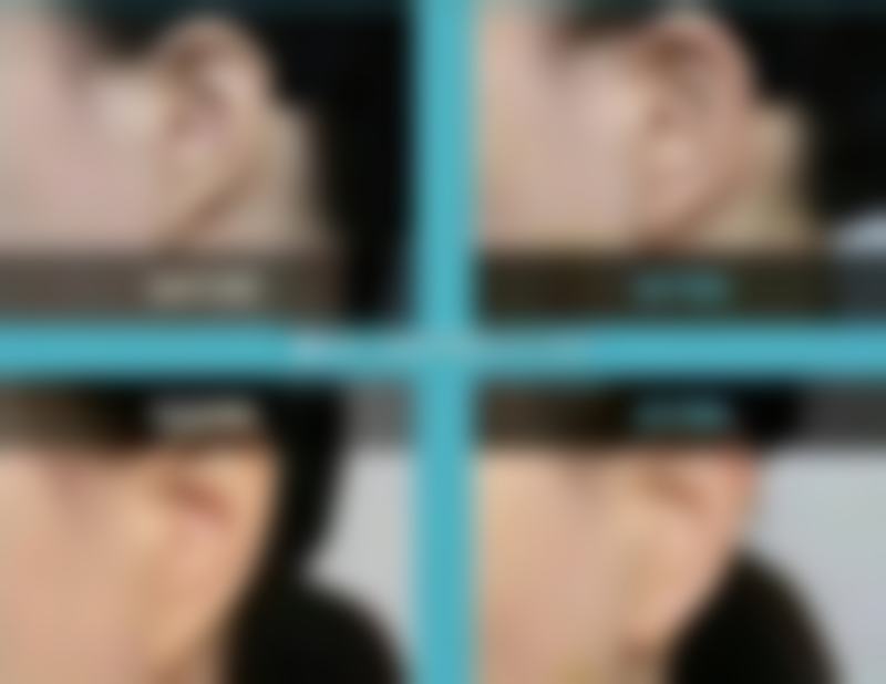 深圳尚嘉医疗美容诊所收费价格表