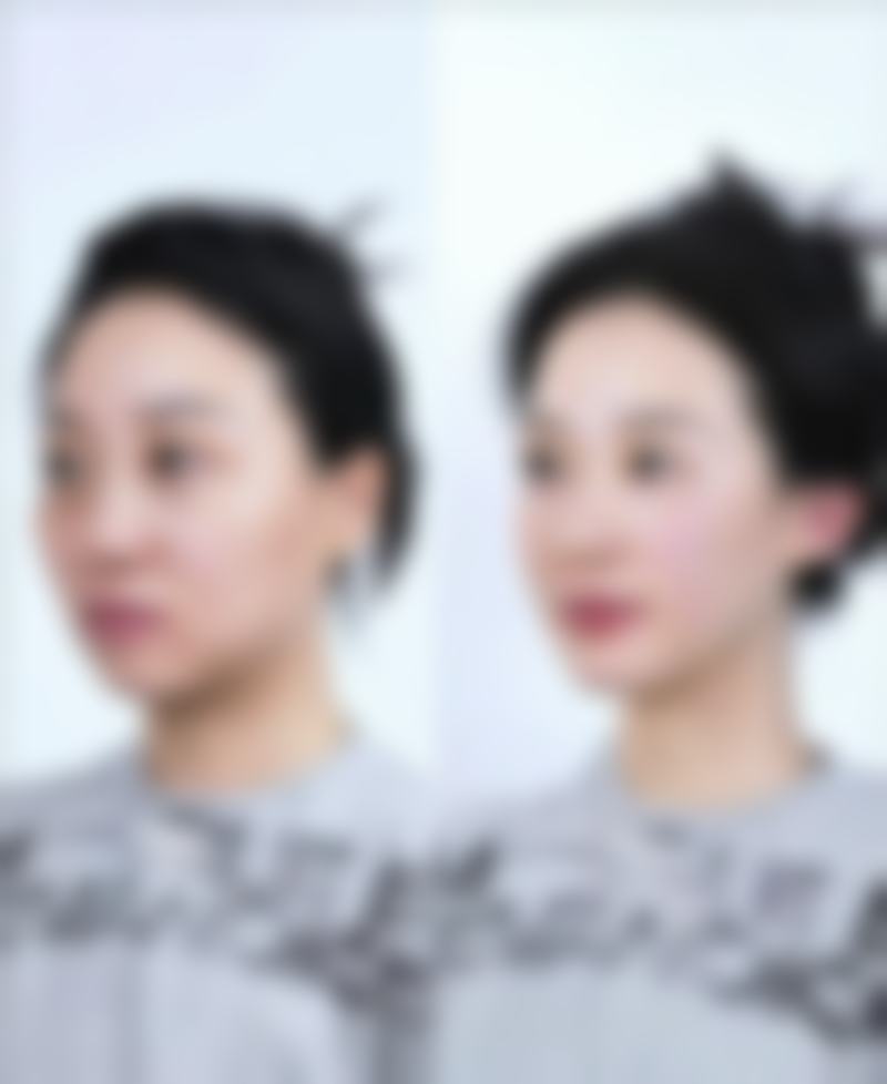 陈小云医生项目收费价格