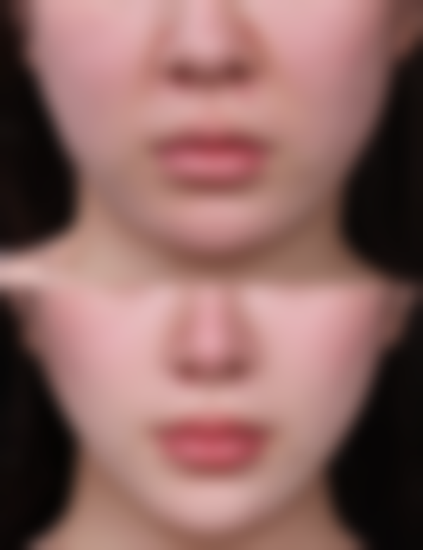 青岛首大医院医疗美容科收费价格表