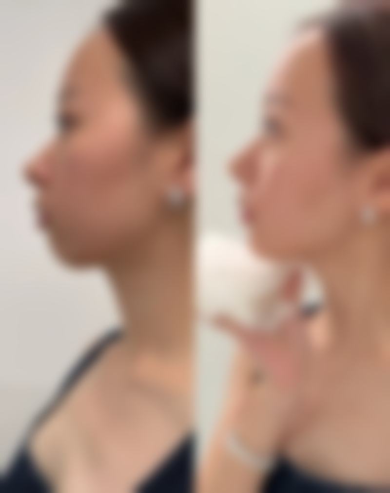 梁婷淇医生项目收费价格