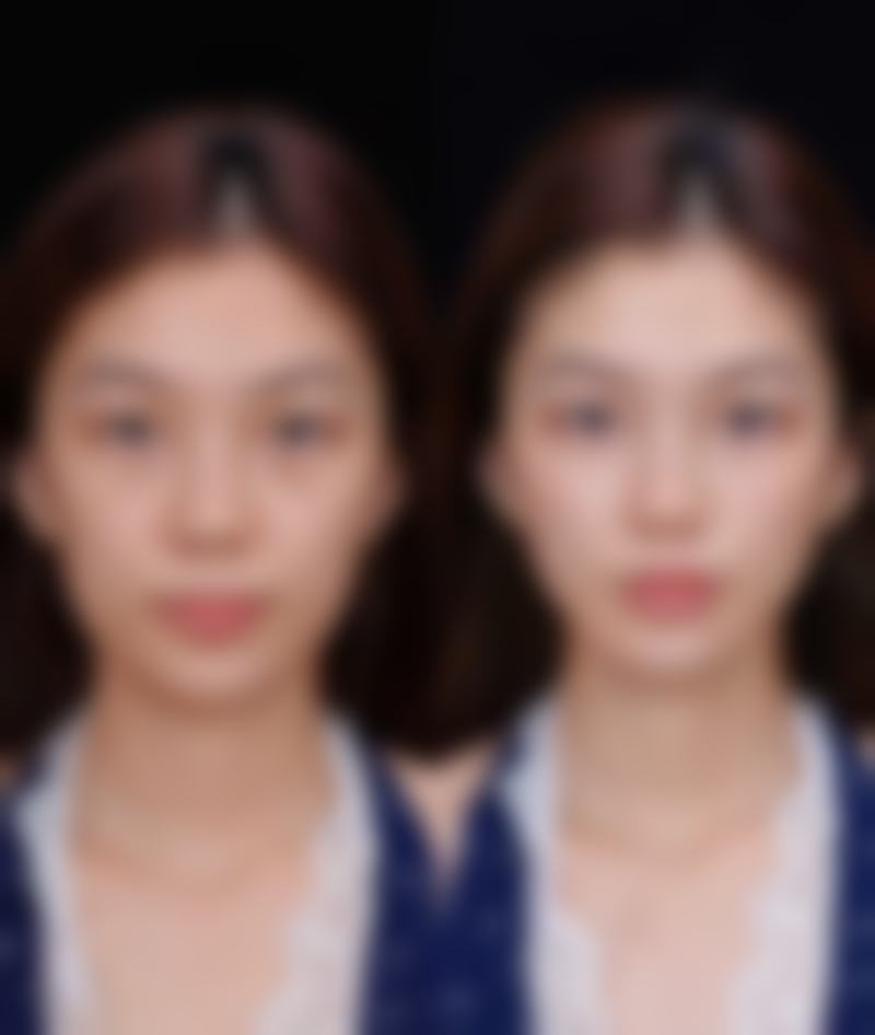 昆明达美医疗美容诊所收费价格表