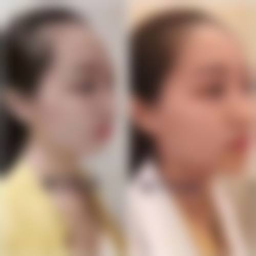 齐向梅医生项目收费价格