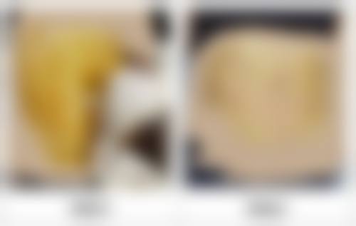 金长旭医生项目收费价格