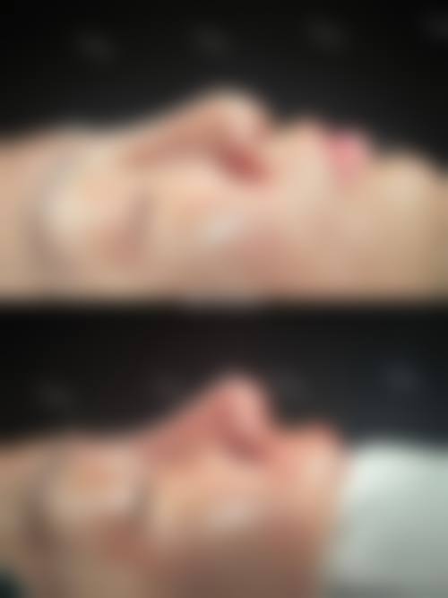 金长旭医生技术优势