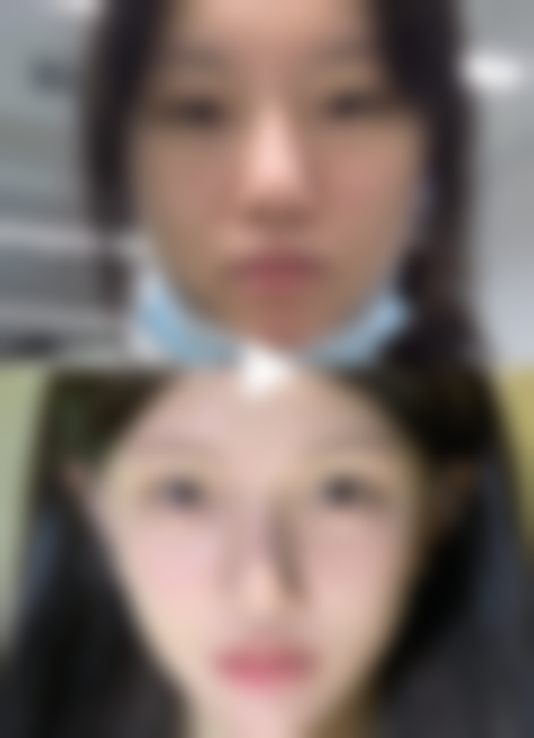 宁波雅韩整形美容医院预约挂号方式