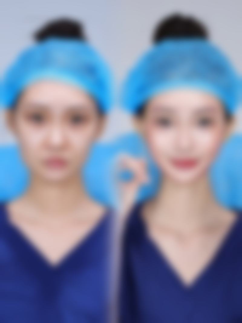 滁州兰积医疗美容诊所预约挂号方式