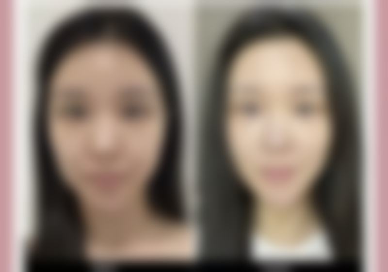 北京曙光医院预约挂号方式