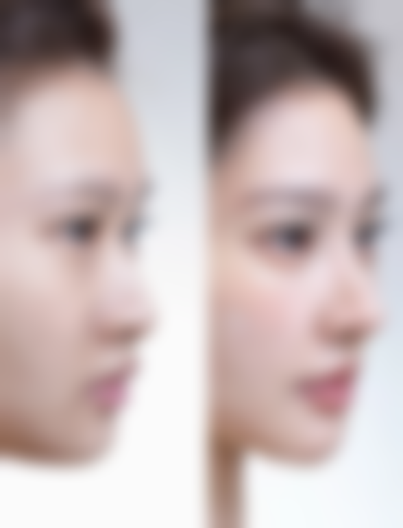 阜新矿业集团总医院烧伤整形科预约挂号方式