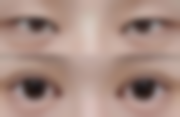 深圳美高壹美整形医院收费价格表