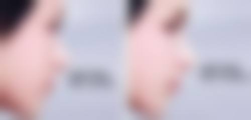 张丛笑医生技术优势