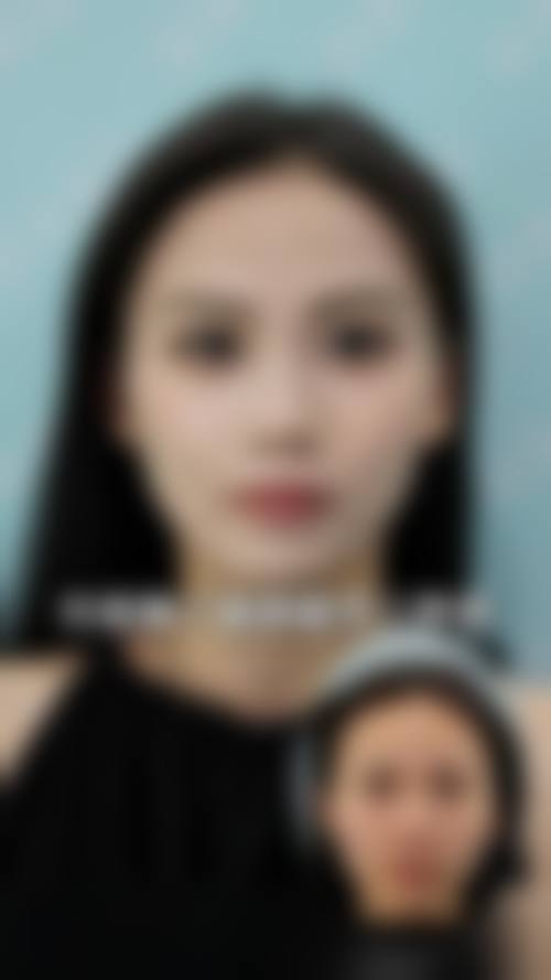 董雪医生技术优势