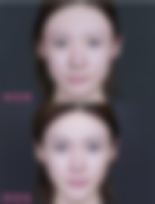 杨斌医生技术优势