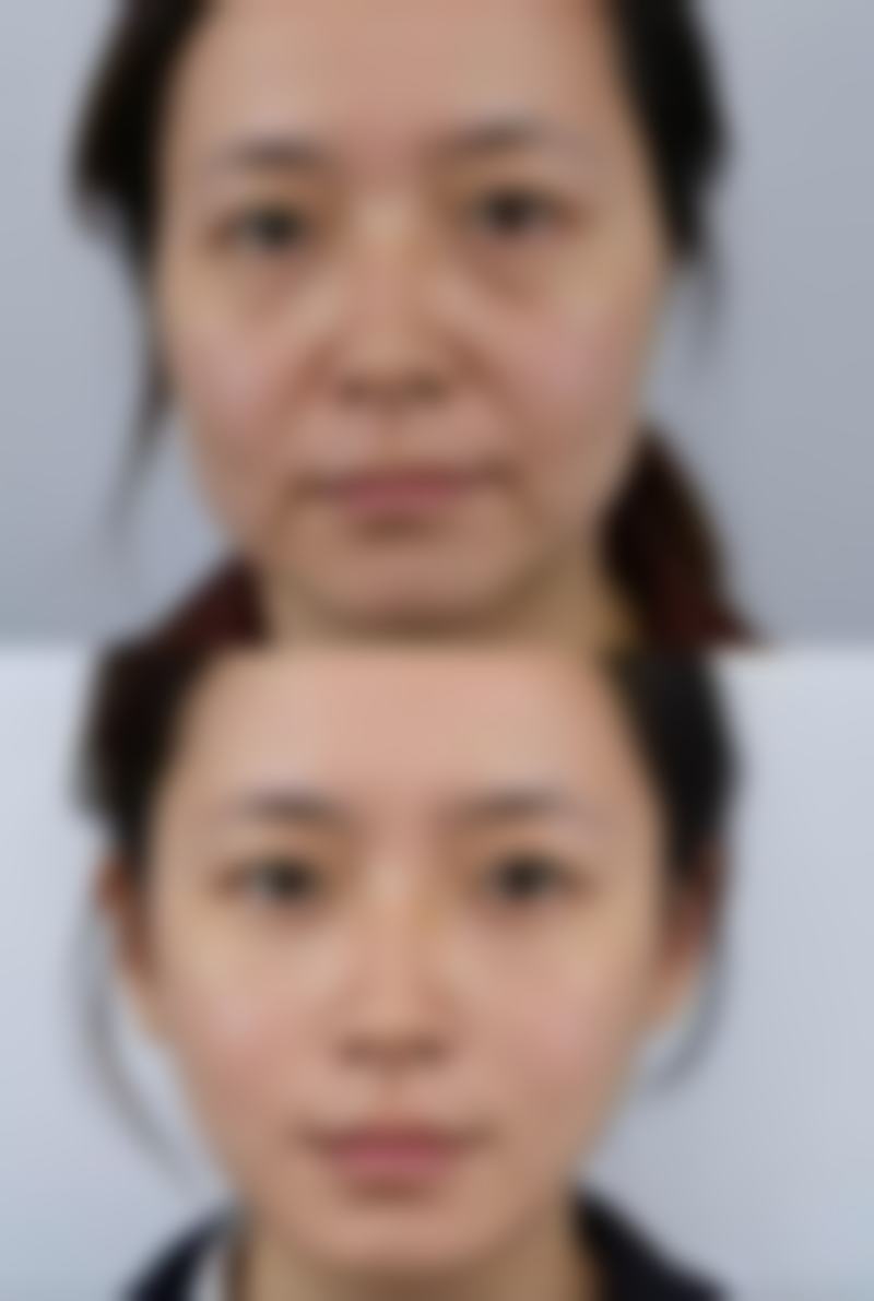 张丛笑医生项目收费价格