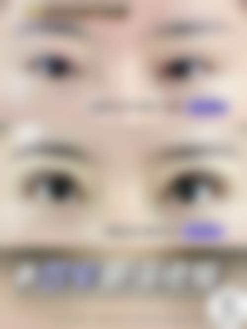 亳州吉娜整形医院预约挂号方式