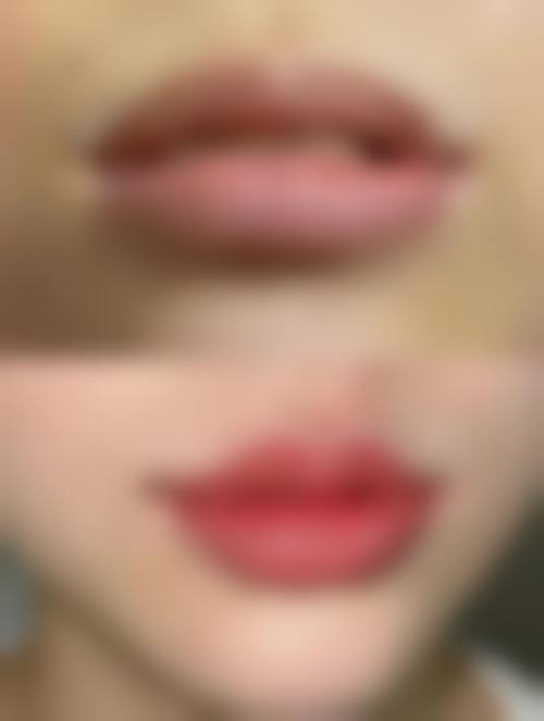 叶锋医生预约挂号