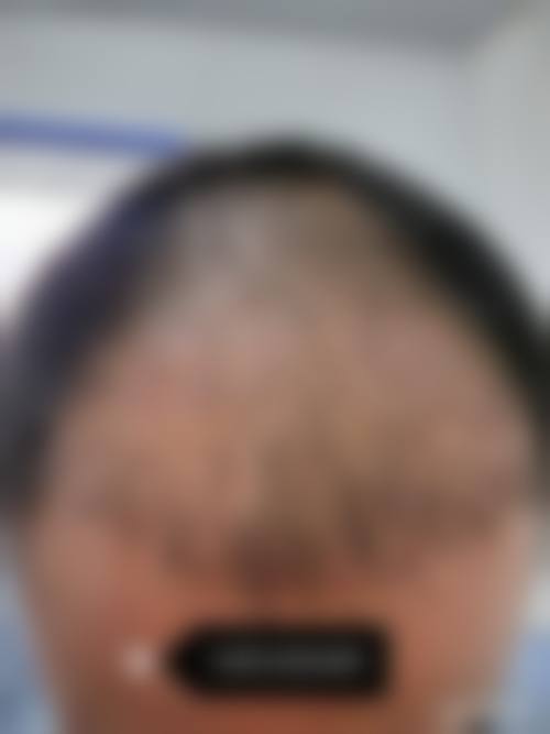 四川成都丝恒植发地址电话、营业时间