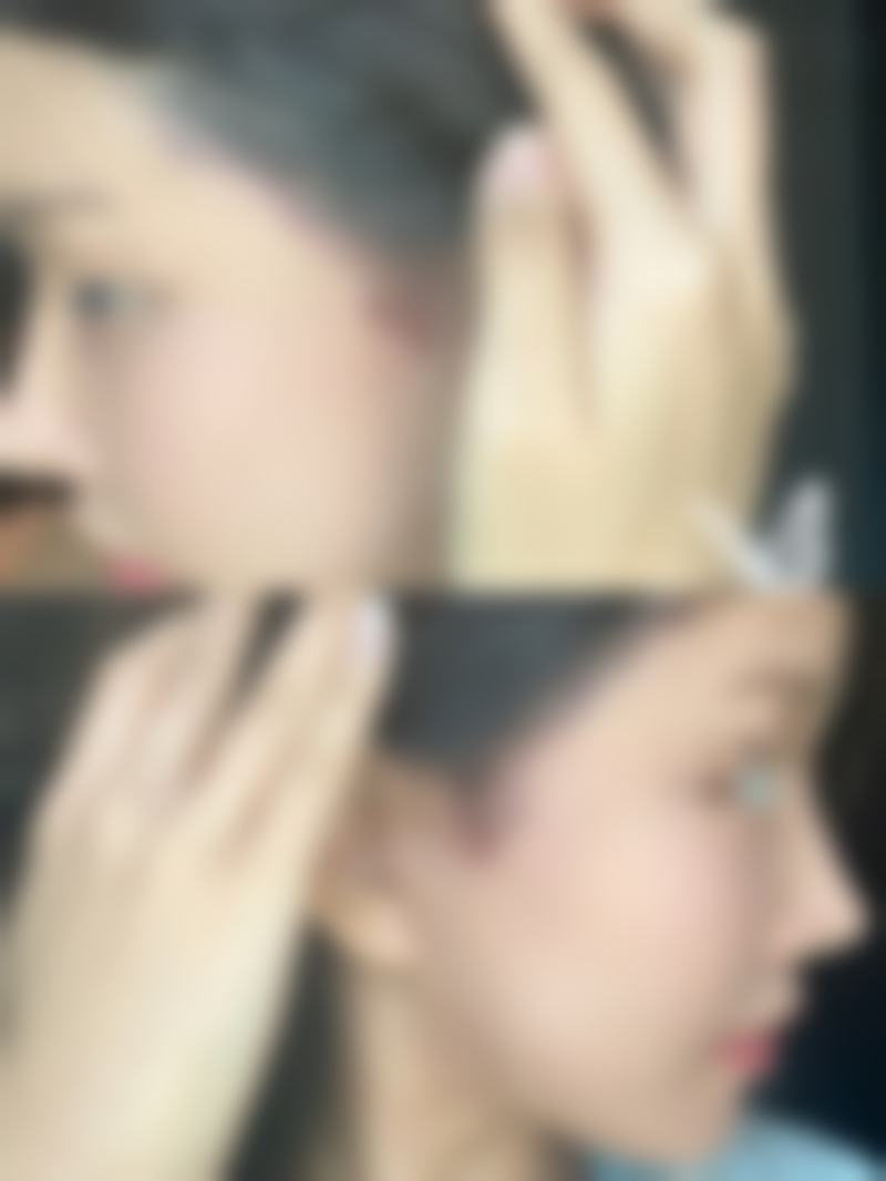 兰溪市永球医院整形美容科预约挂号方式