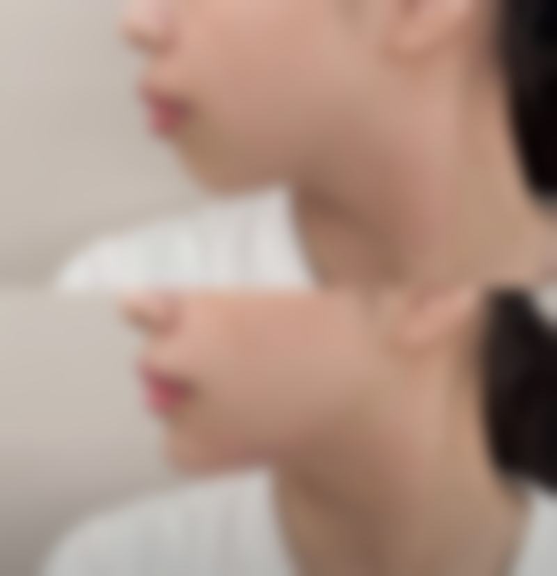 叶锋医生项目收费价格