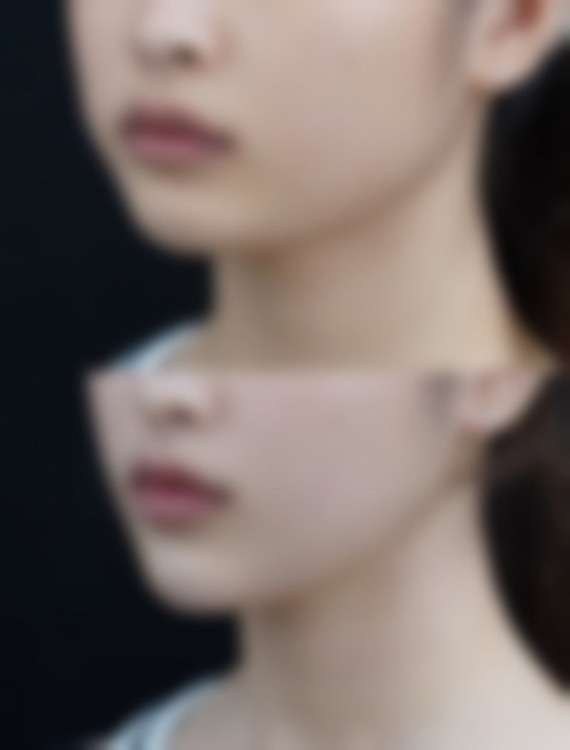 叶锋医生技术优势