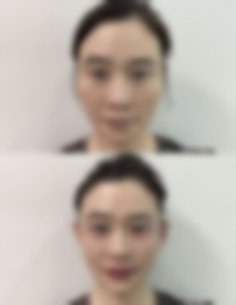 西安艺美医疗美容收费价格表