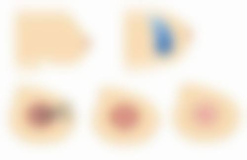 黄楷医生口碑评价及反馈内容