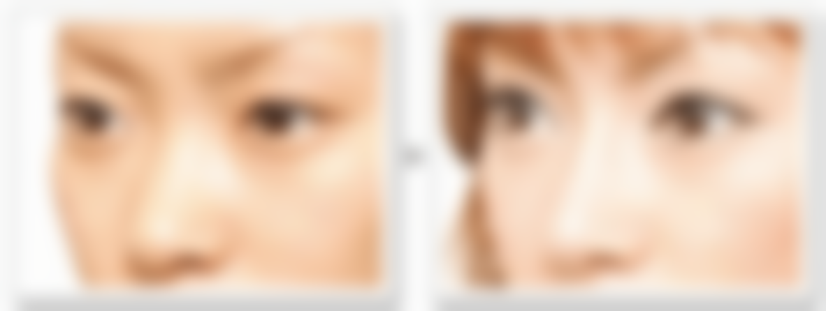 王肖琴医生项目收费价格