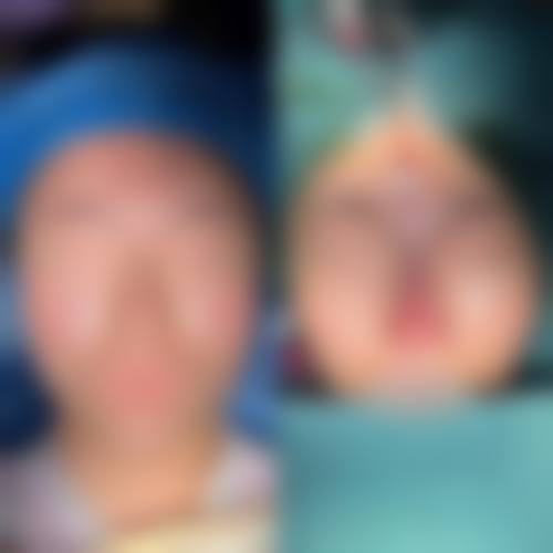 游桂萍医生技术优势