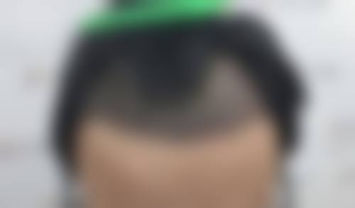 武警黑龙江总队医院整形美容科预约挂号方式