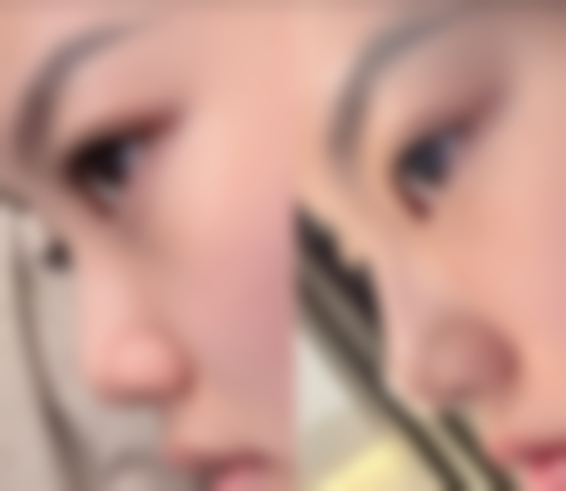 合肥瑶海福华整形医疗美容医院预约挂号方式