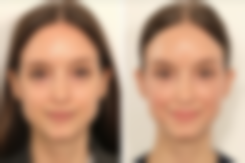 威海福神整形医院预约挂号方式