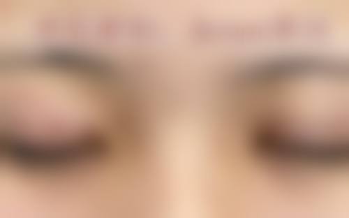 周立意医生项目收费价格