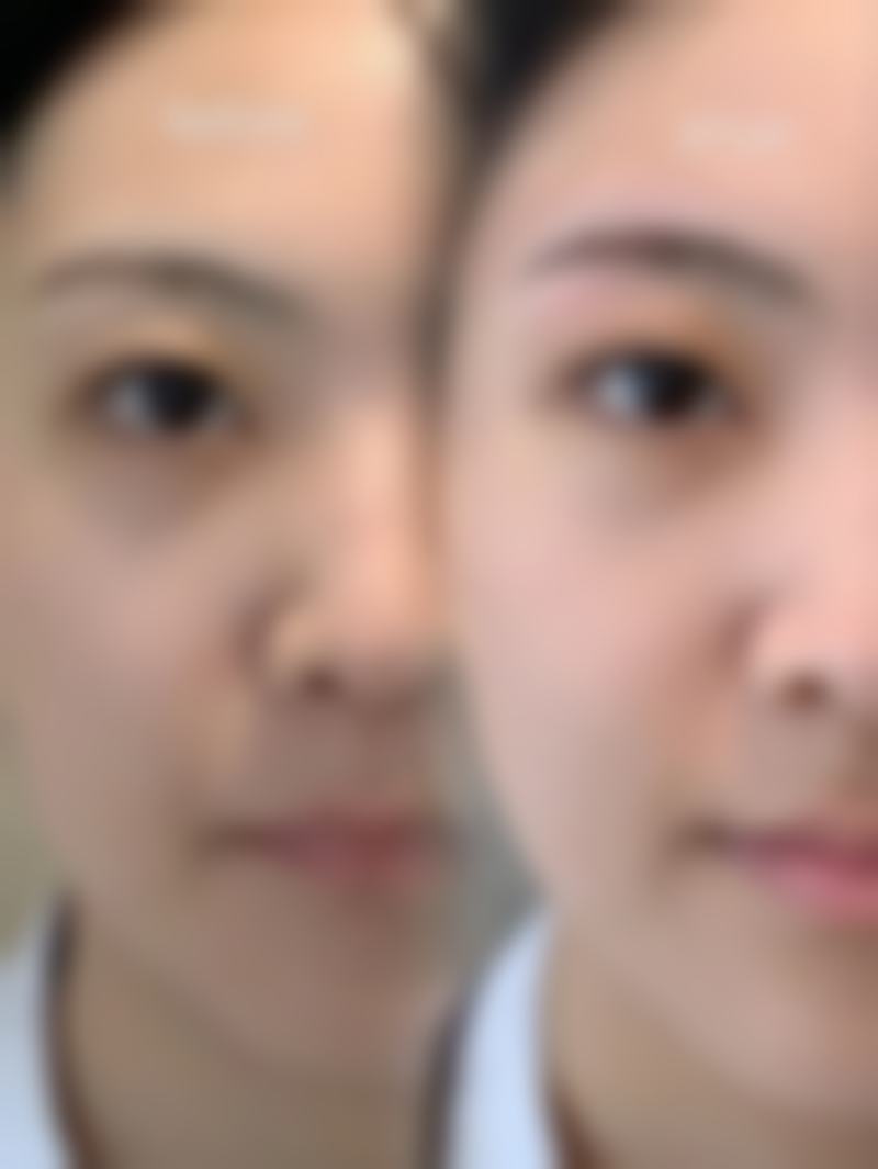 都匀瑾美人整形医院收费价格表