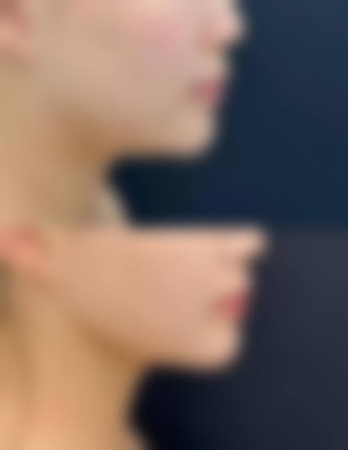 南京苏朗美容医院收费价格表