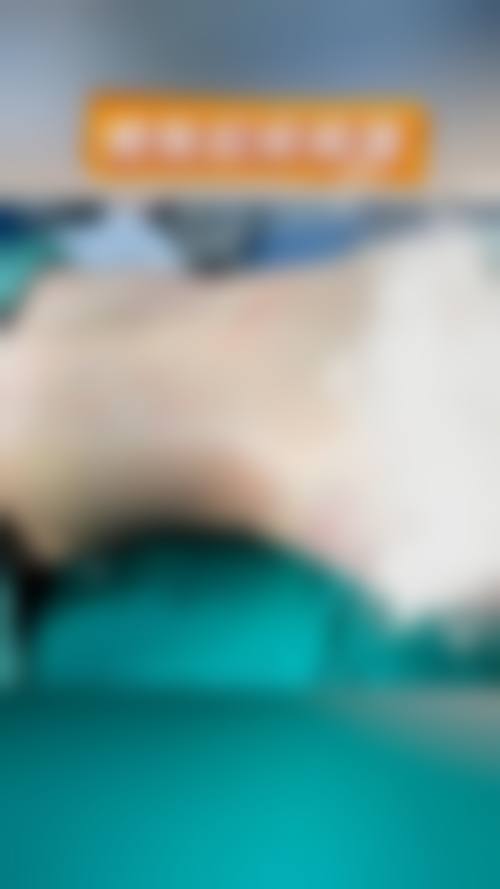 张燕雄医生预约挂号