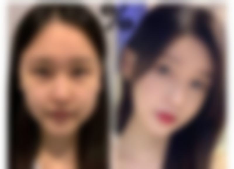 殷明英医生项目收费价格