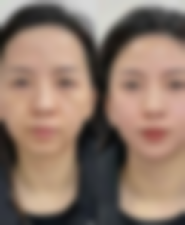 Regina Clinic 京都河原町预约挂号方式