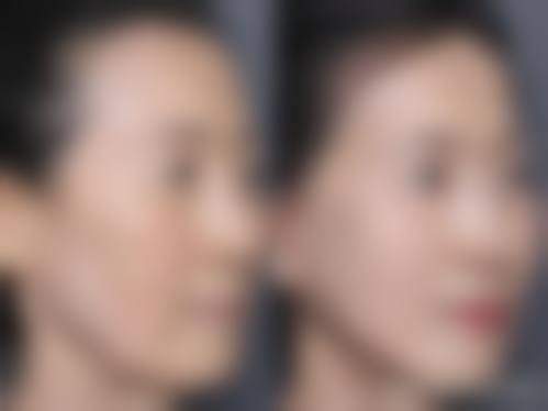 游桂萍医生技术优势