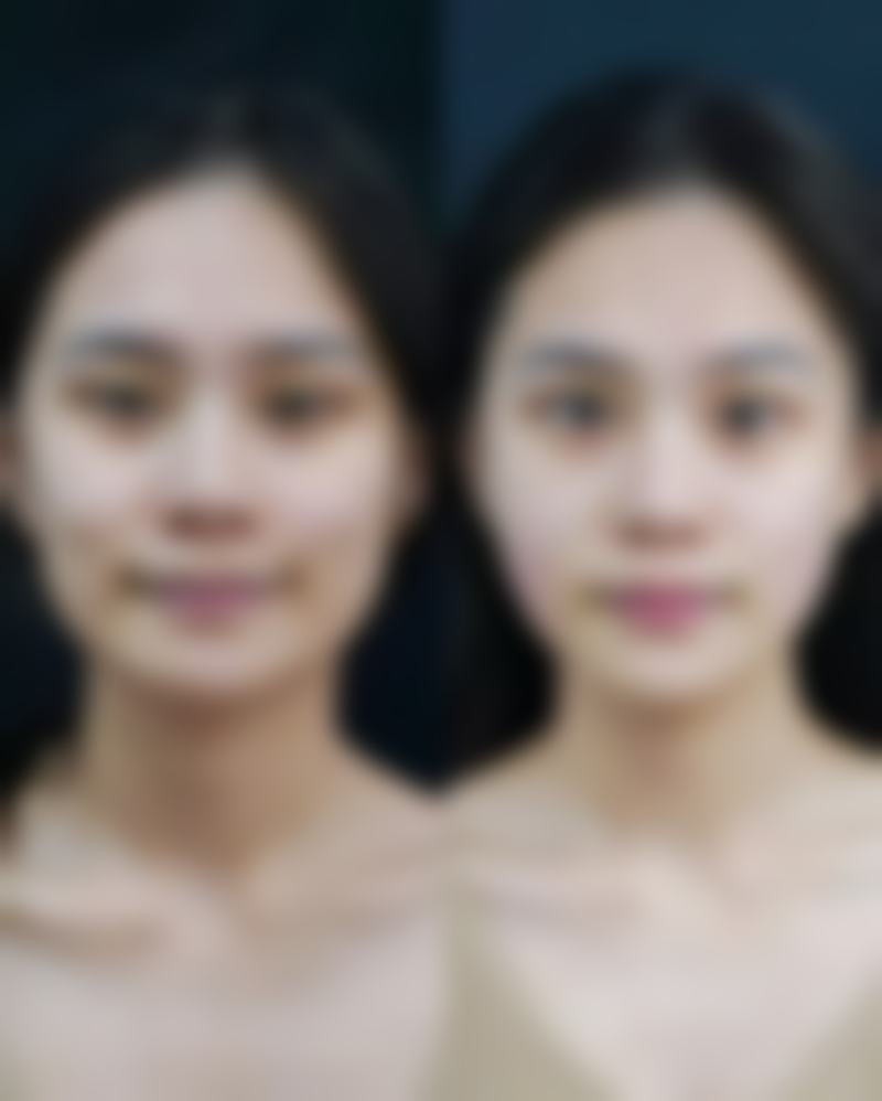 呼和浩特京美整形美容医院收费价格表