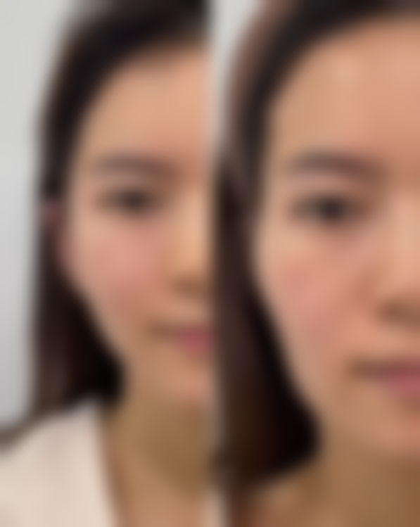 甘肃兰州斯美瑞医美预约挂号方式