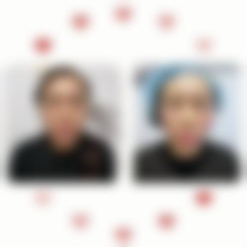 吕影医生技术优势