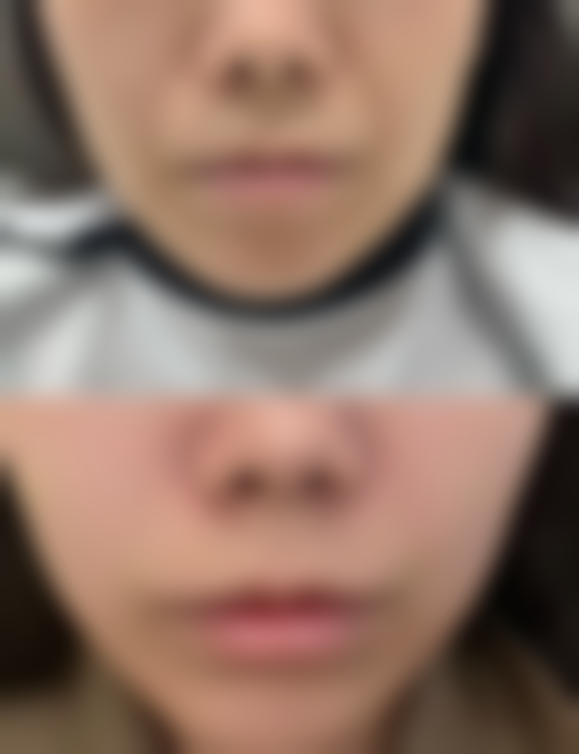 南充知肤整形医院预约挂号方式