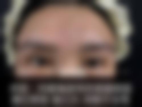 谢尚生医生项目收费价格