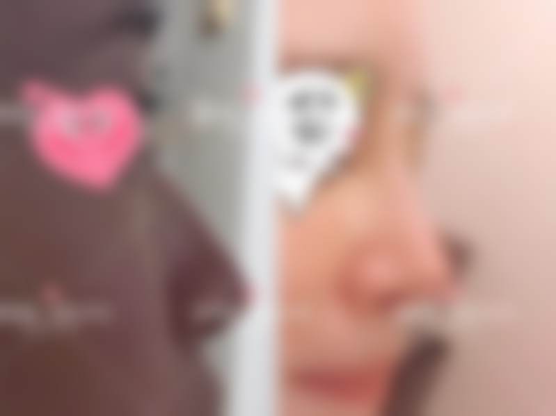 李丙玟医生口碑评价及反馈内容