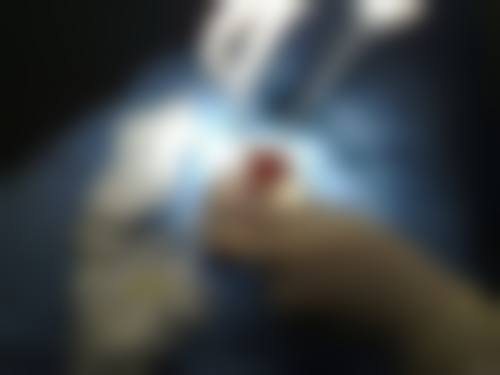 杨光华医生技术优势